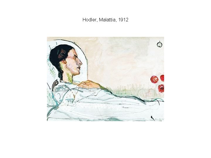 Hodler, Malattia, 1912 