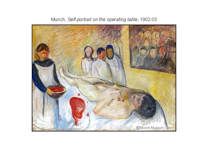 Munch, Self-portrait on the operating table, 1902 -03 