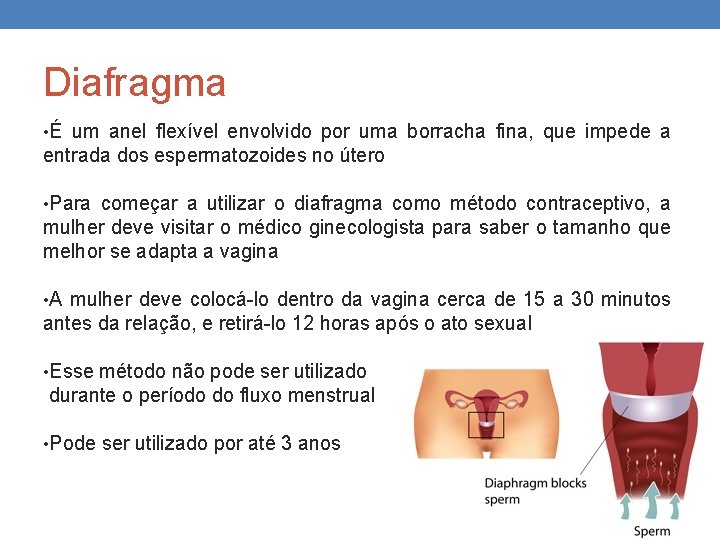 Diafragma • É um anel flexível envolvido por uma borracha fina, que impede a Diafragma • É um anel flexível envolvido por uma borracha fina, que impede a