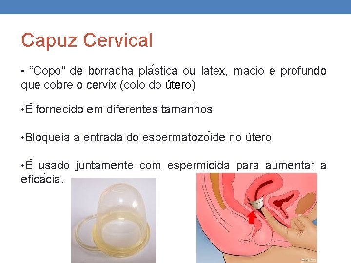 Capuz Cervical • “Copo” de borracha pla stica ou latex, macio e profundo que Capuz Cervical • “Copo” de borracha pla stica ou latex, macio e profundo que
