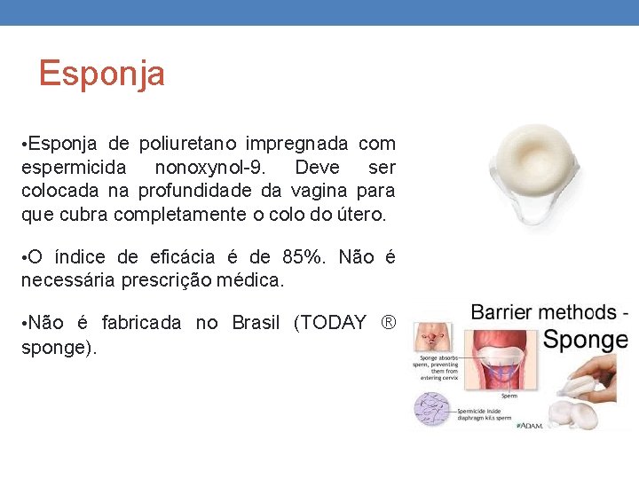 Esponja • Esponja de poliuretano impregnada com espermicida nonoxynol-9. Deve ser colocada na profundidade Esponja • Esponja de poliuretano impregnada com espermicida nonoxynol-9. Deve ser colocada na profundidade