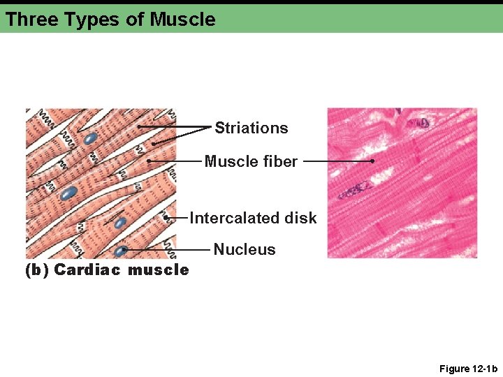 Three Types of Muscle Striations Muscle fiber Intercalated disk (b) Cardiac muscle Nucleus Figure