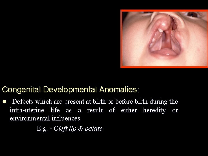 Congenital Developmental Anomalies: l Defects which are present at birth or before birth during