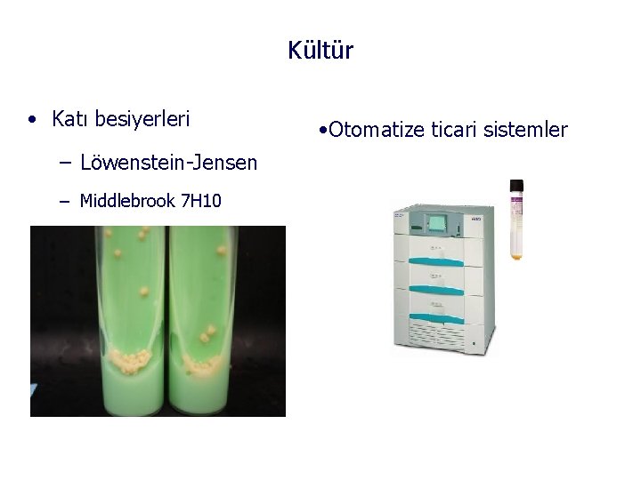 Kültür • Katı besiyerleri – Löwenstein-Jensen – Middlebrook 7 H 10 • Otomatize ticari