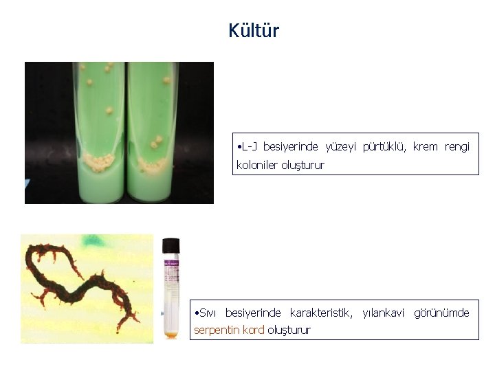 Kültür • L-J besiyerinde yüzeyi pürtüklü, krem rengi koloniler oluşturur • Sıvı besiyerinde karakteristik,