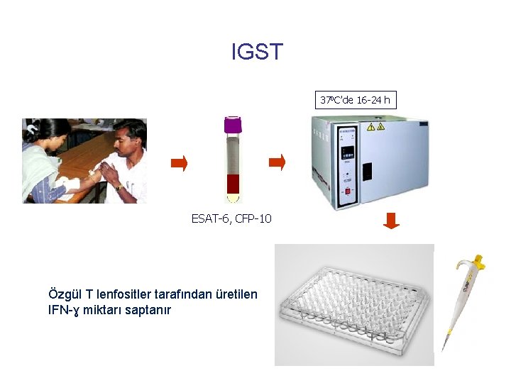 IGST 370 C’de 16 -24 h ESAT-6, CFP-10 Özgül T lenfositler tarafından üretilen IFN-ɣ