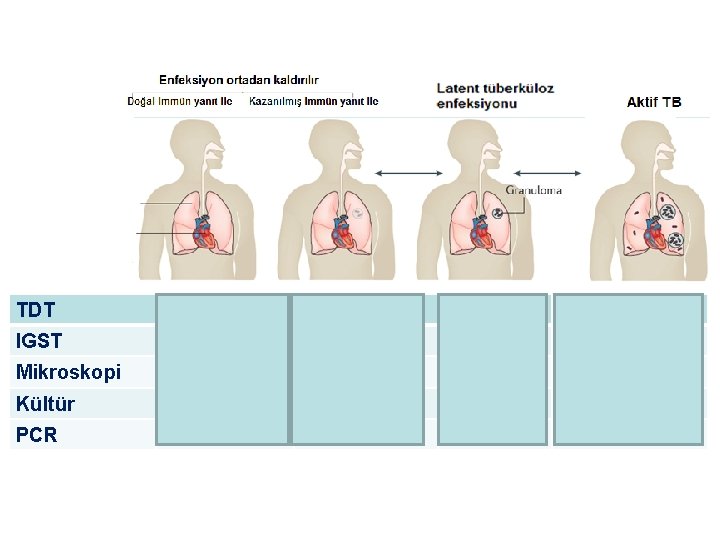 TDT Negatif Pozitif IGST Negatif Pozitif Mikroskopi Negatif Genellikle pozitif Kültür Negatif Pozitif PCR