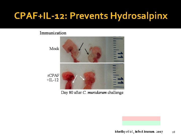 CPAF+IL-12: Prevents Hydrosalpinx Murthy et al. , Infect Immun. 2007 28 