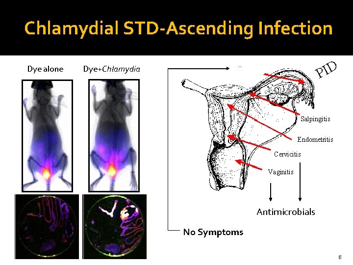 Chlamydial STD-Ascending Infection Dye alone PID Dye+Chlamydia Salpingitis Endometritis Cervicitis Vaginitis Antimicrobials No Symptoms