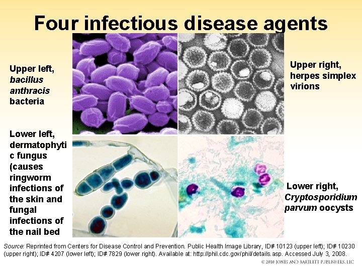 Four infectious disease agents Upper left, bacillus anthracis bacteria Lower left, dermatophyti c fungus