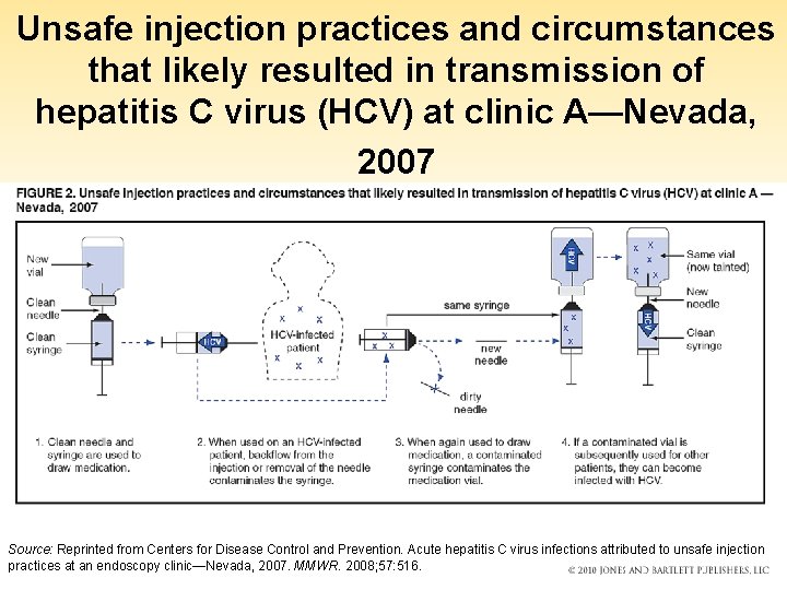 Unsafe injection practices and circumstances that likely resulted in transmission of hepatitis C virus
