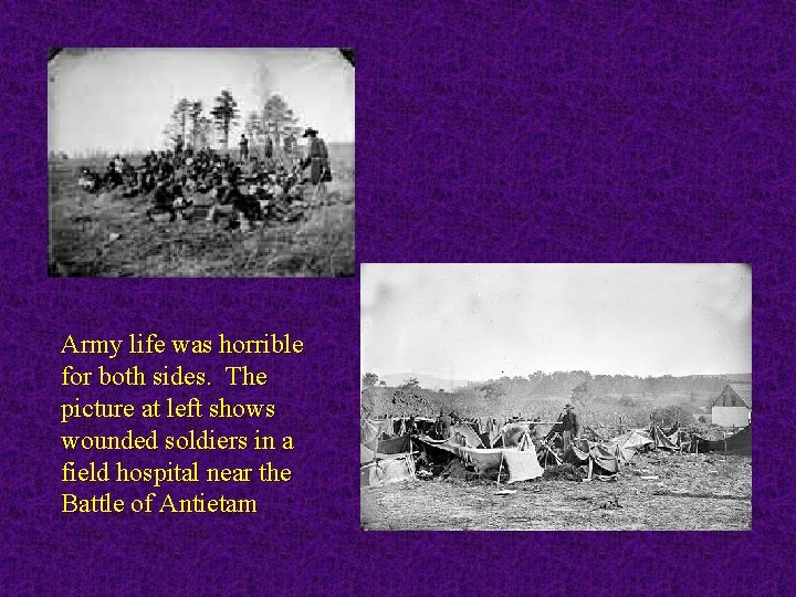 Army life was horrible for both sides. The picture at left shows wounded soldiers