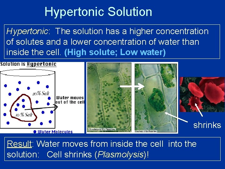 Hypertonic Solution Hypertonic: The solution has a higher concentration of solutes and a lower
