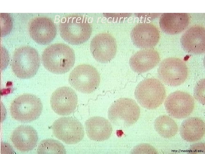 Borrelia recurrentis http: //medinfo. ufl. edu 