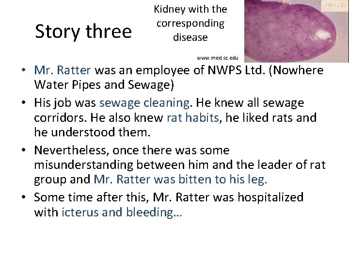 Story three Kidney with the corresponding disease www. med. sc. edu • Mr. Ratter