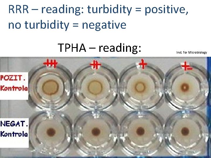 RRR – reading: turbidity = positive, no turbidity = negative TPHA – reading: Inst.