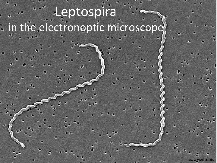 Leptospira in the electronoptic microscope www. med. sc. edu 