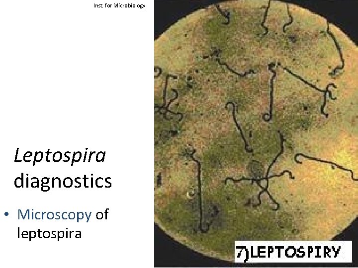 Inst. for Microbiology Leptospira diagnostics • Microscopy of leptospira 