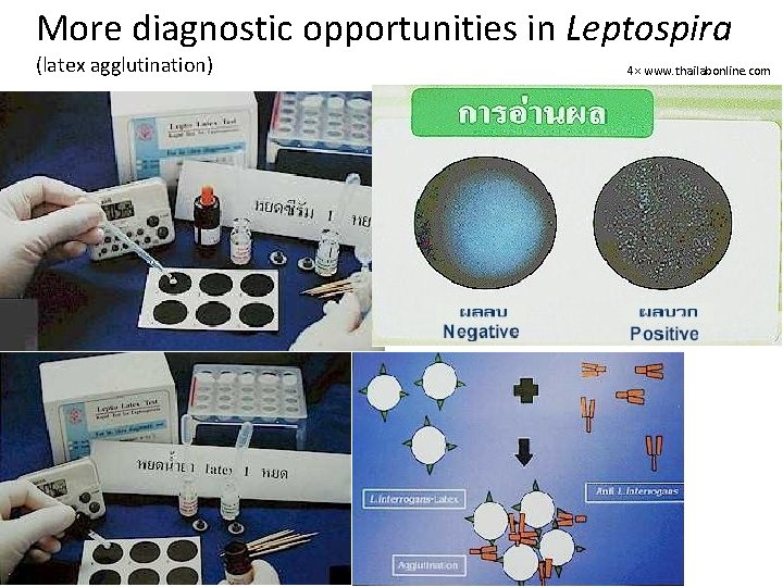 More diagnostic opportunities in Leptospira (latex agglutination) 4× www. thailabonline. com 