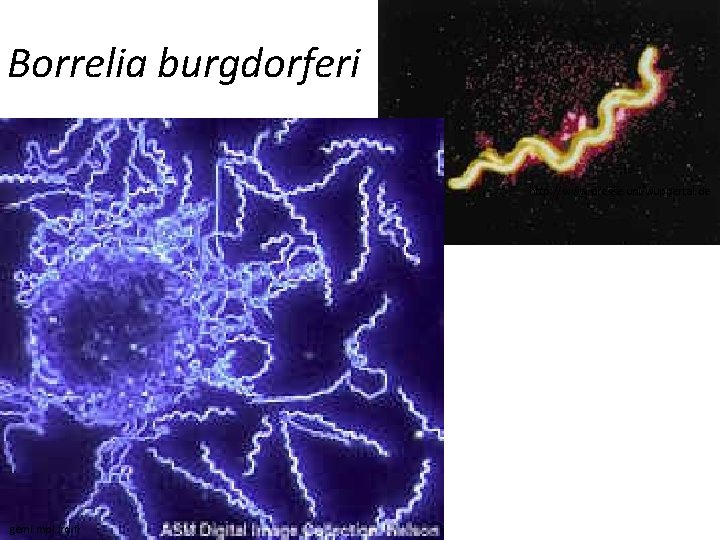 Borrelia burgdorferi http: //www. presse. uni-wuppertal. de gemi. mpl. ird. fr 