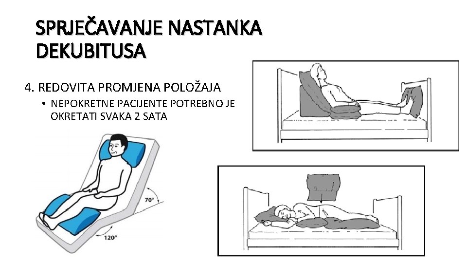 SPRJEČAVANJE NASTANKA DEKUBITUSA 4. REDOVITA PROMJENA POLOŽAJA • NEPOKRETNE PACIJENTE POTREBNO JE OKRETATI SVAKA