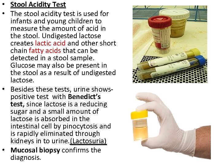  • Stool Acidity Test • The stool acidity test is used for infants