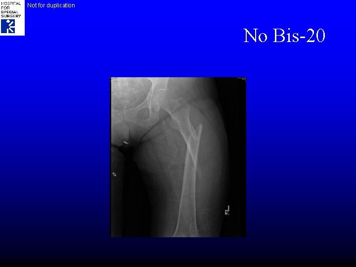 Not for duplication No Bis-20 
