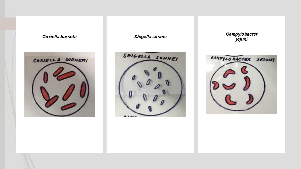 Coxiella burnetii Shigella sonnei Campylobacter jejuni 