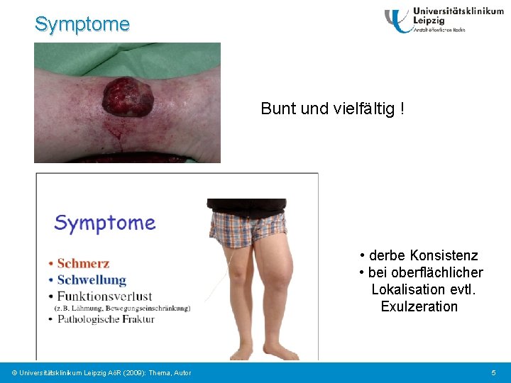 Symptome Bunt und vielfältig ! • derbe Konsistenz • bei oberflächlicher Lokalisation evtl. Exulzeration