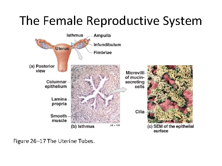 The Female Reproductive System Figure 26– 17 The Uterine Tubes. 
