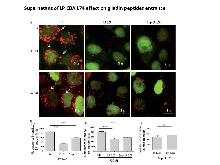 Supernatant of LP CBA L 74 effect on gliadin peptides entrance 