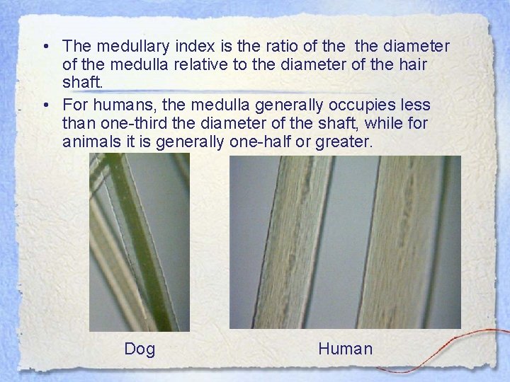  • The medullary index is the ratio of the diameter of the medulla