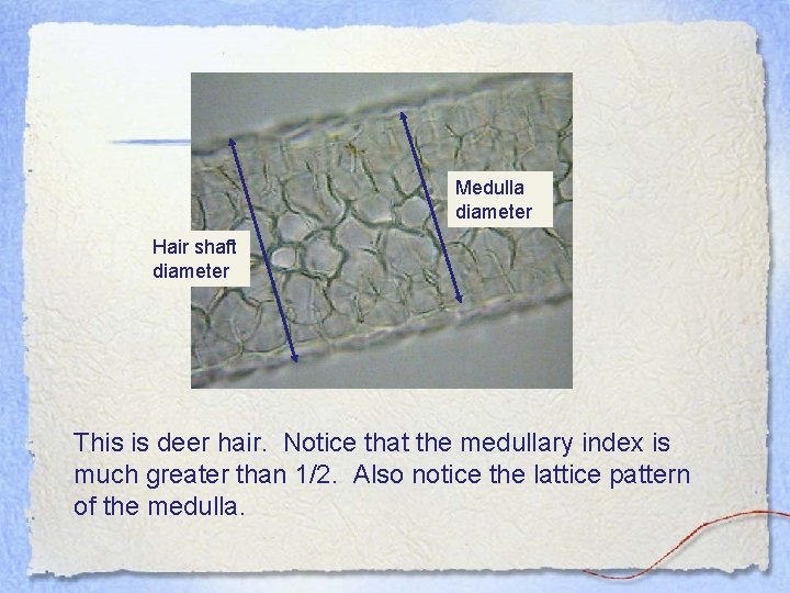 Medulla diameter Hair shaft diameter This is deer hair. Notice that the medullary index