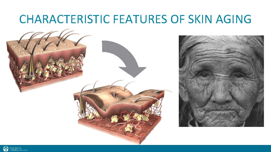 CHARACTERISTIC FEATURES OF SKIN AGING 