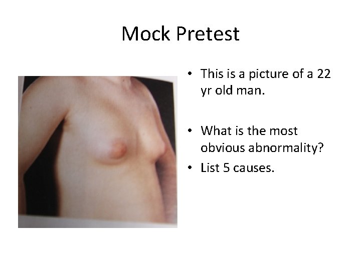 Mock Pretest • This is a picture of a 22 yr old man. •