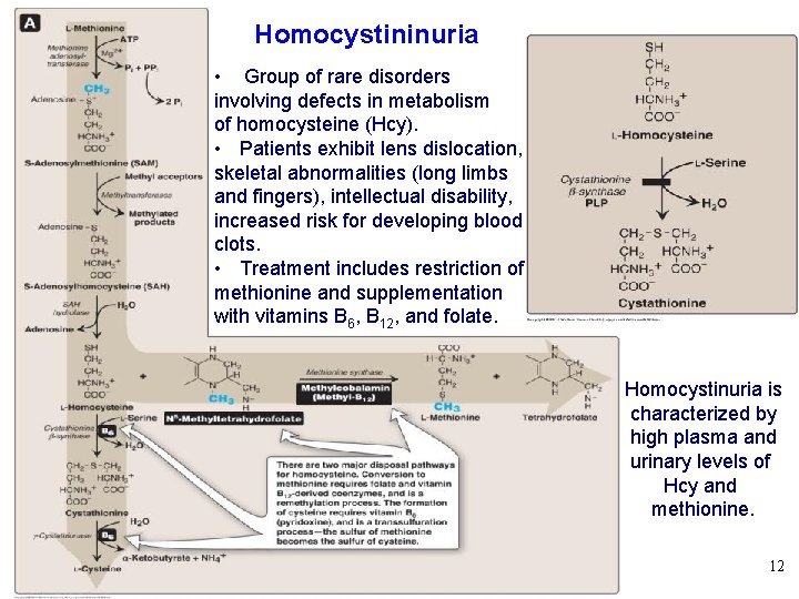 Homocystininuria • Group of rare disorders involving defects in metabolism of homocysteine (Hcy). •