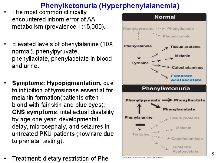 Phenylketonuria (Hyperphenylalanemia) • The most common clinically encountered inborn error of AA metabolism (prevalence
