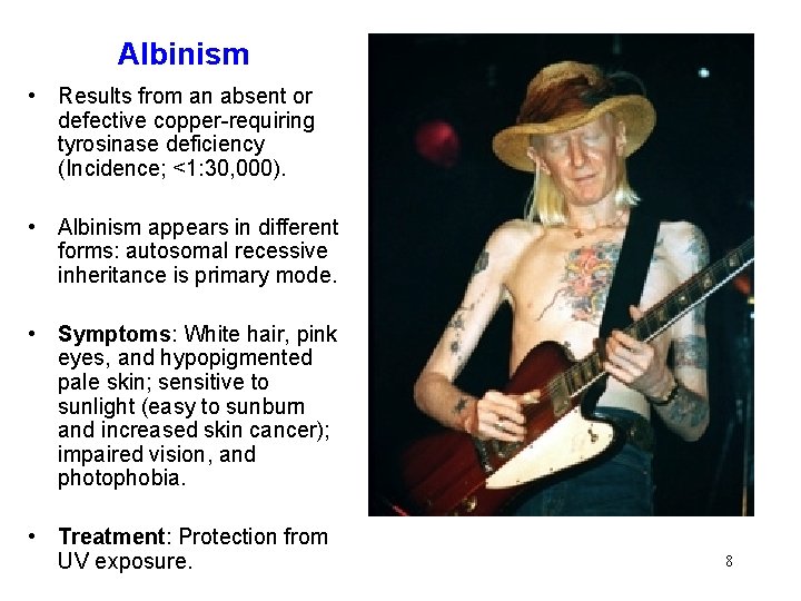 Albinism • Results from an absent or defective copper-requiring tyrosinase deficiency (Incidence; <1: 30,