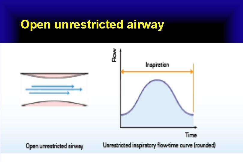 Open unrestricted airway 