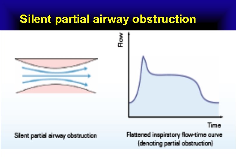 Silent partial airway obstruction 