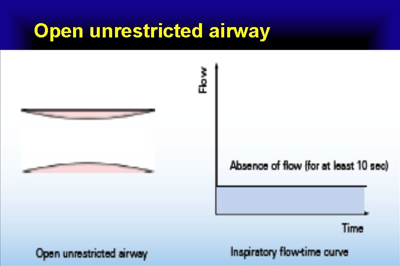 Open unrestricted airway 