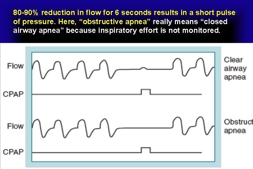 80 -90% reduction in flow for 6 seconds results in a short pulse of