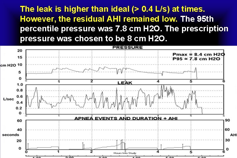 The leak is higher than ideal (> 0. 4 L/s) at times. However, the