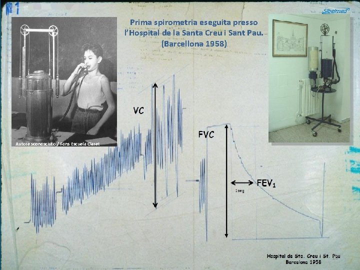 Prima spirometria eseguita presso l’Hospital de la Santa Creu i Sant Pau. (Barcellona 1958)