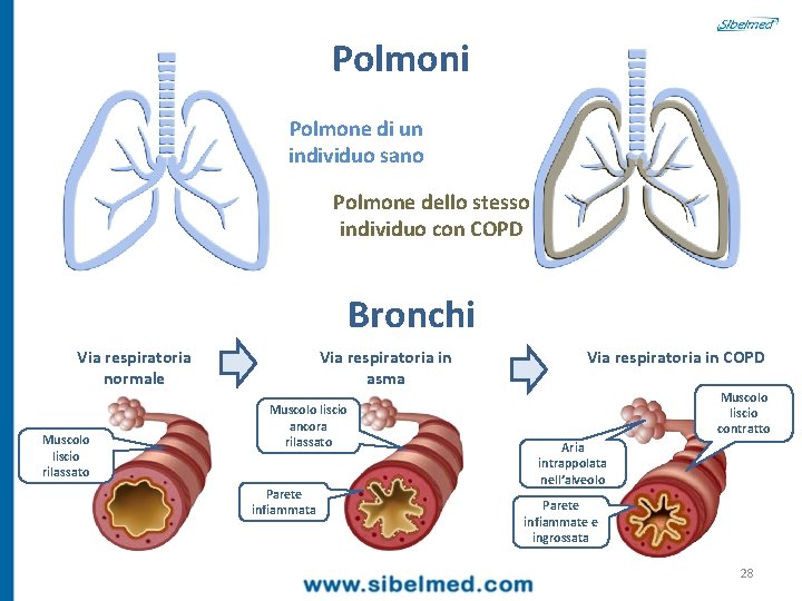 Polmoni Polmone di un individuo sano Polmone dello stesso individuo con COPD Bronchi Via