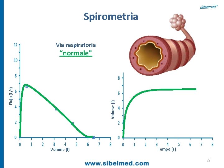Spirometria Via respiratoria Volume (l) Flujo (L/s) “normale” Volume (l) Tempo (s) 29 