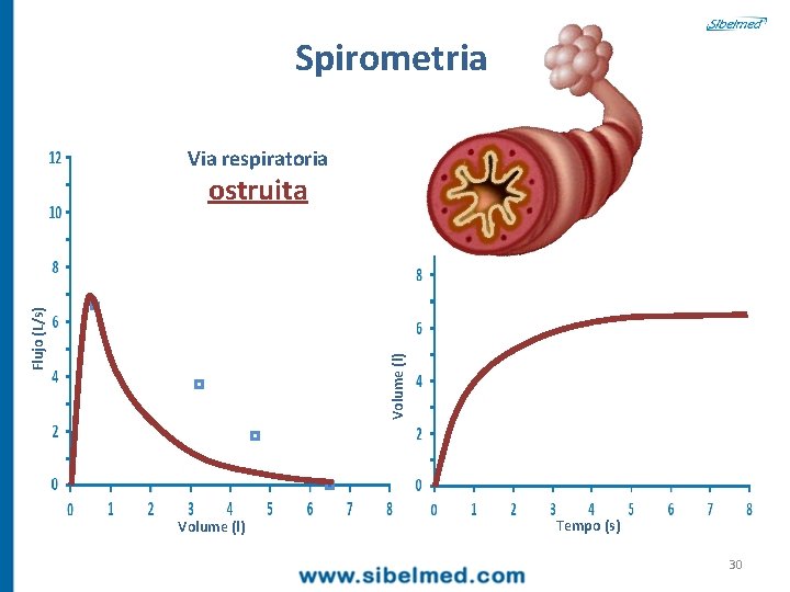 Spirometria Via respiratoria Volume (l) Flujo (L/s) ostruita Volume (l) Tempo (s) 30 