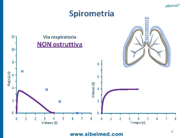Spirometria Via respiratoria Volume (l) Flujo (L/s) NON ostruttiva Volume (l) Tempo (s) 31