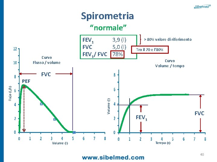 Spirometria “normale” Curva Flusso / volume > 80% valore di riferimento Tra il 70