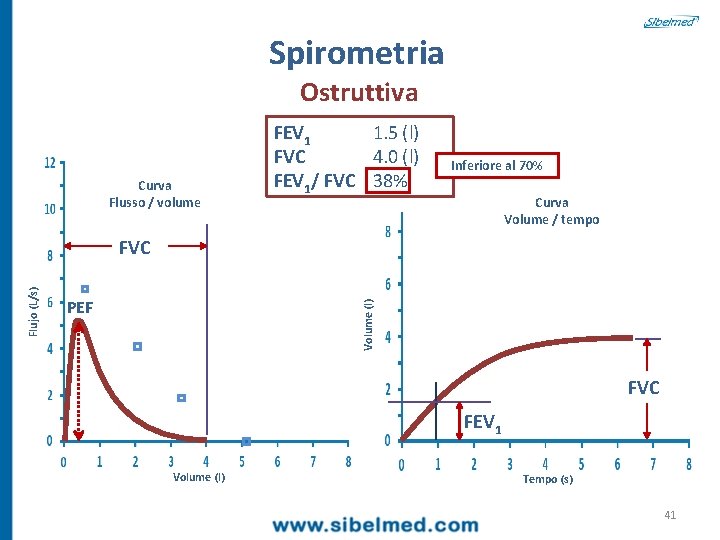 Spirometria Ostruttiva Curva Flusso / volume FEV 1 1. 5 (l) FVC 4. 0